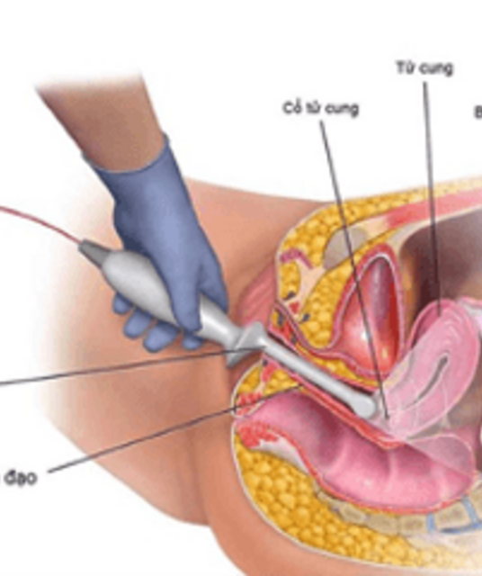 avatar sieuamsanphukhoa
